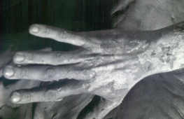 Spanish Artist*s Hand
